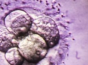 ‌2024温州二院试管婴儿费用大公开！全面费用明细清单，助您预算无忧